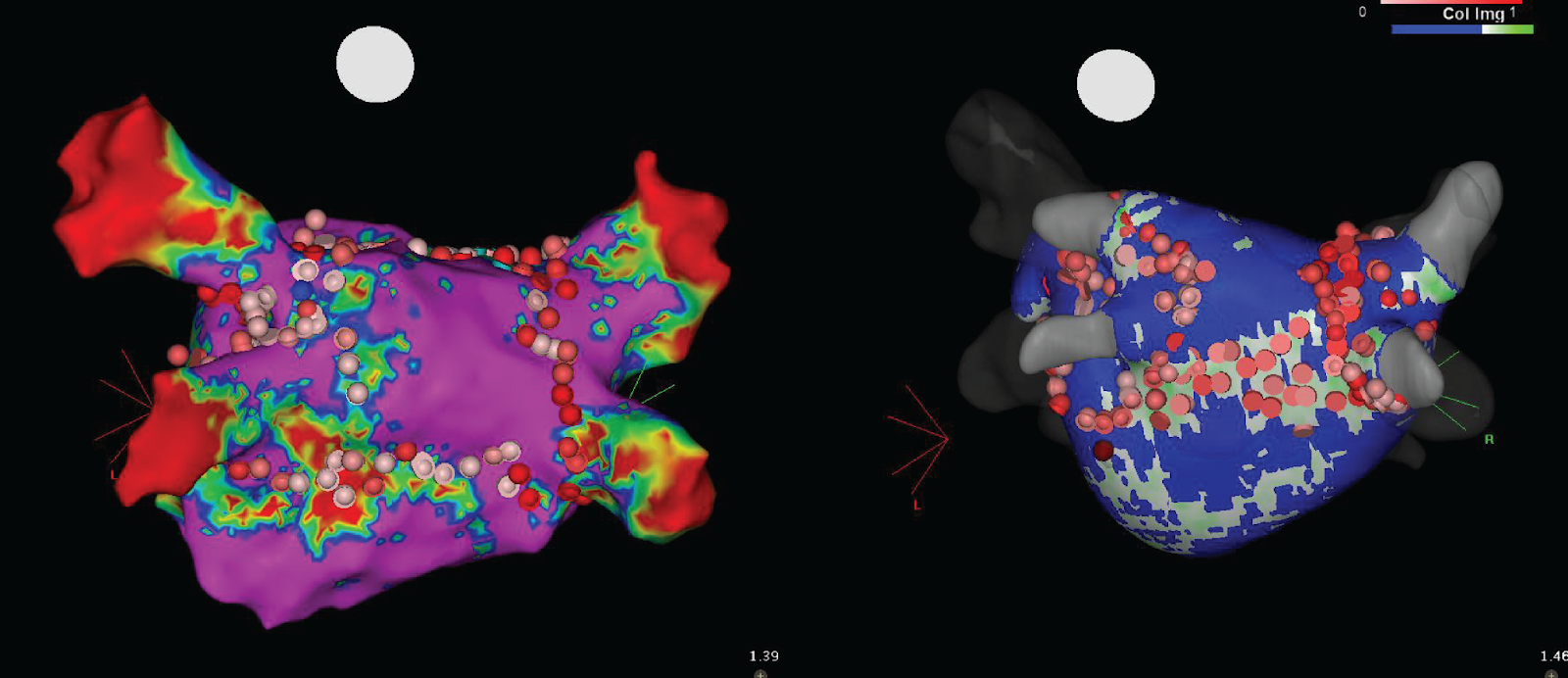 Cardiac Electrophysiology
