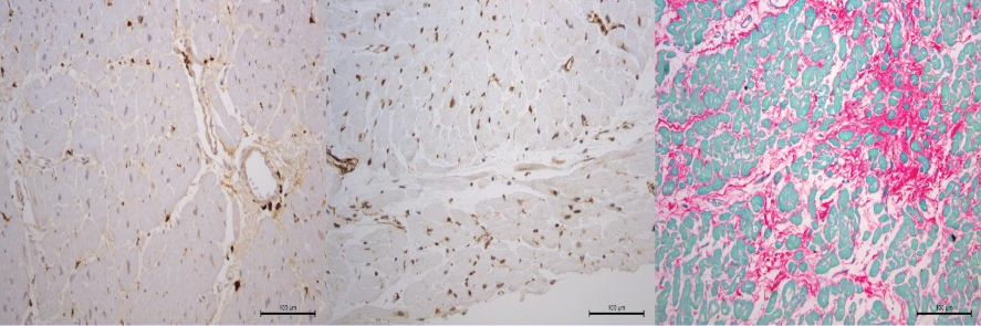 Cardiac biology sample