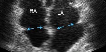 Heart scan