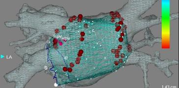 CARDIAC ELECTROPHYSIOLOGY