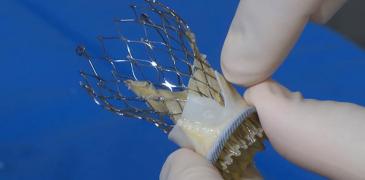 Heart valve