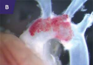 B) Heart and proximal aorta of mouse with deletion of type II TGF-beta receptor in smooth muscle cells.