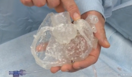 3D printed heart