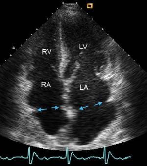 Heart scan