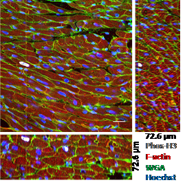 High-resolution 3D reconstruction of Normal Adult Human Heart 