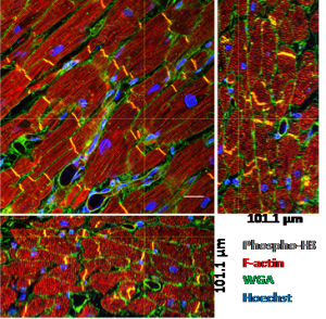 High-resolution 3D reconstruction of Normal Adult Human Heart 