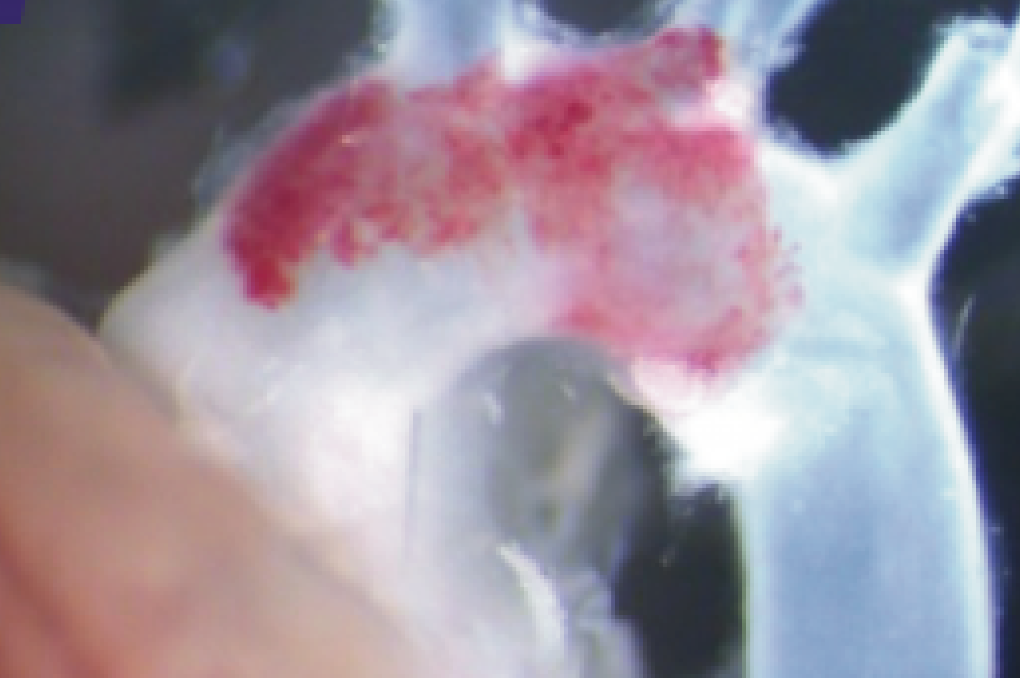 Vascular research imaging